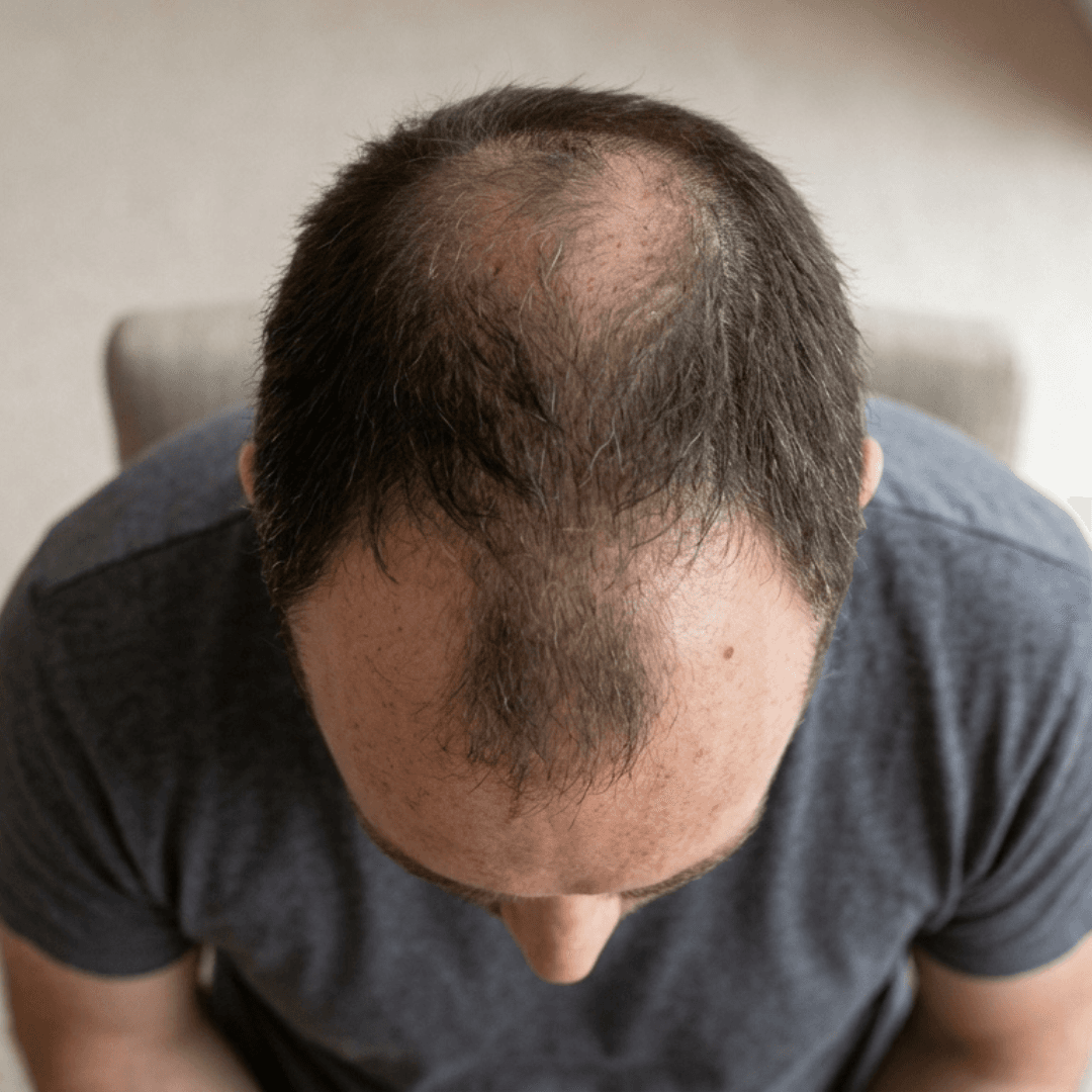 Native ad concept - Editorial style